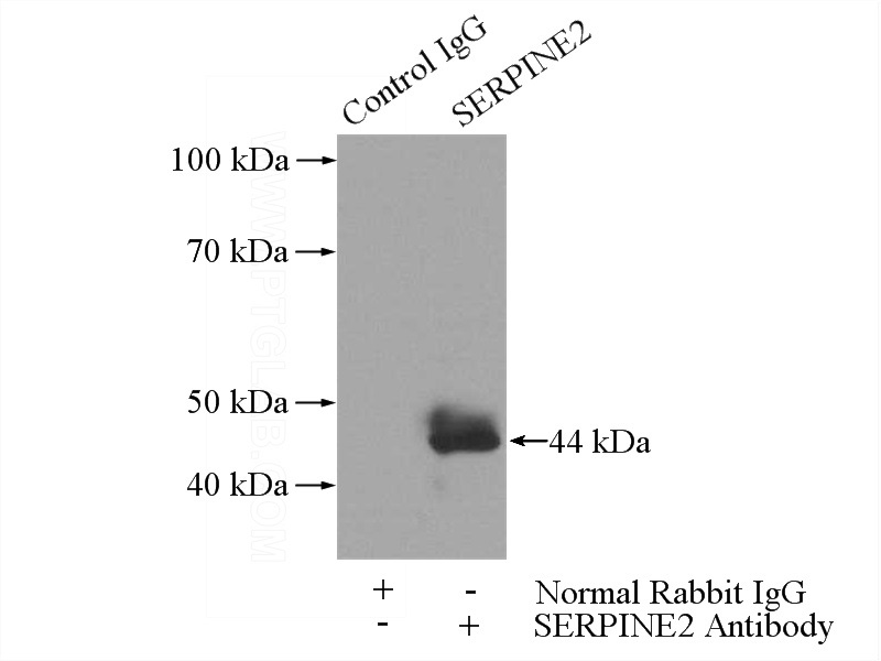 IP Result of anti-SERPINE2 (IP:Catalog No:115208, 3ug; Detection:Catalog No:115208 1:300) with A549 cells lysate 2800ug.