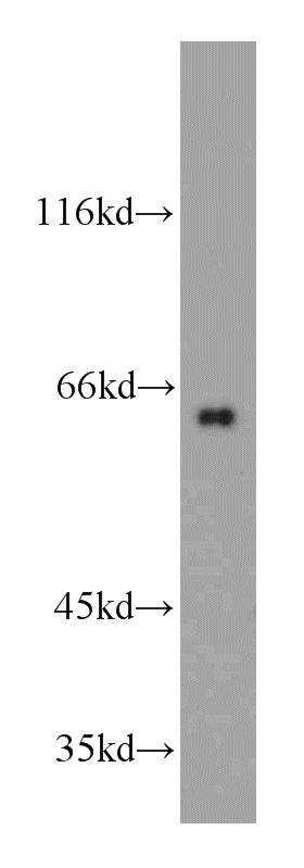 L02 cells were subjected to SDS PAGE followed by western blot with Catalog No:115375(SLC38A4 antibody) at dilution of 1:200