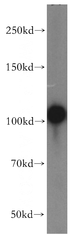HepG2 cells were subjected to SDS PAGE followed by western blot with Catalog No:107712(ACTN4 antibody) at dilution of 1:500