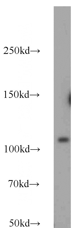 HEK-293 cells were subjected to SDS PAGE followed by western blot with Catalog No:108049(AR antibody) at dilution of 1:1000