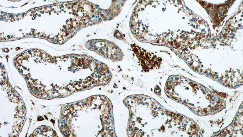 Immunohistochemistry of paraffin-embedded human testis tissue slide using Catalog No:114864(RTN4 Antibody) at dilution of 1:50 (under 10x lens)