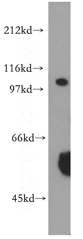 K-562 cells were subjected to SDS PAGE followed by western blot with Catalog No:116995(XPO7 antibody) at dilution of 1:300