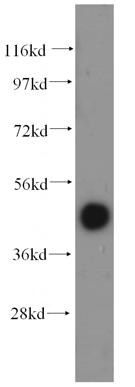 human testis tissue were subjected to SDS PAGE followed by western blot with Catalog No:110579(FAM175A antibody) at dilution of 1:500