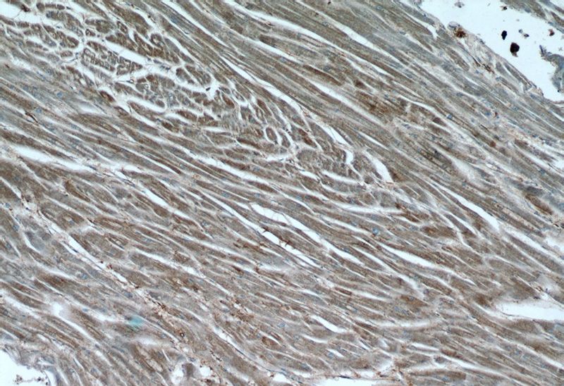 Immunohistochemistry of paraffin-embedded human heart tissue slide using Catalog No:109896(DES Antibody) at dilution of 1:50 (under 10x lens)