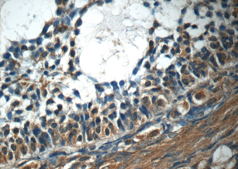 Immunohistochemistry of paraffin-embedded human ovary tissue slide using Catalog No:111981(KIAA0430 Antibody) at dilution of 1:50 (under 40x lens)
