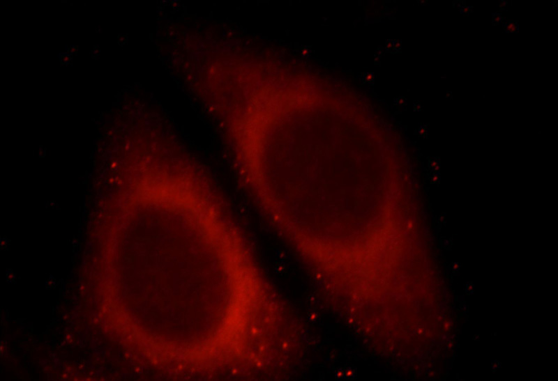 Immunofluorescent analysis of HepG2 cells, using LRRC8C antibody Catalog No:112337 at 1:25 dilution and Rhodamine-labeled goat anti-rabbit IgG (red).