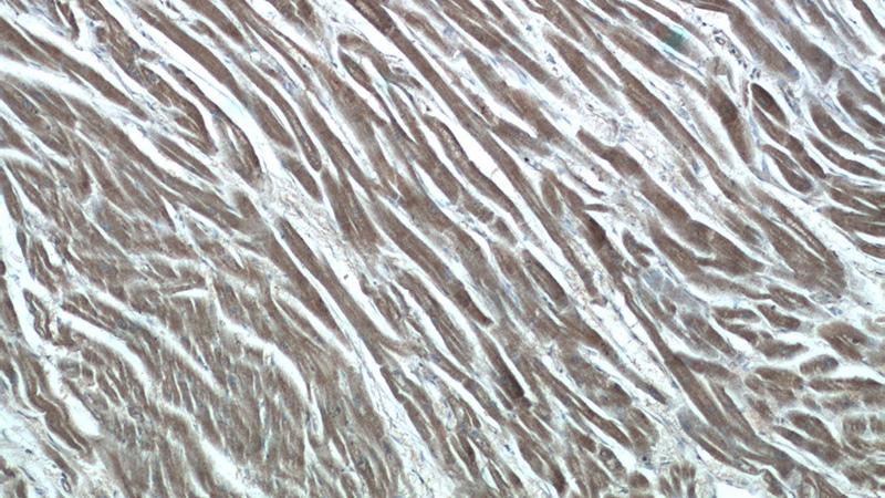 Immunohistochemistry of paraffin-embedded human heart tissue slide using Catalog No:111248(GUCY1A3 Antibody) at dilution of 1:50 (under 10x lens)