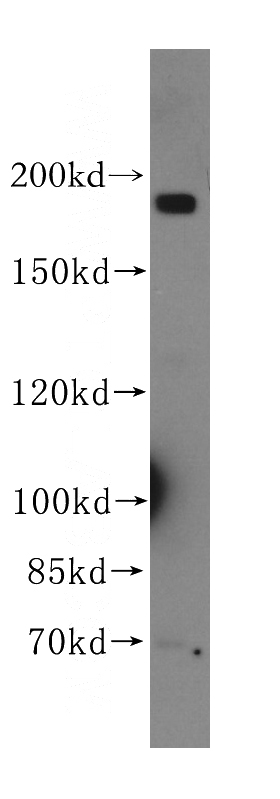 mouse brain tissue were subjected to SDS PAGE followed by western blot with Catalog No:109965(DNMBP antibody) at dilution of 1:500
