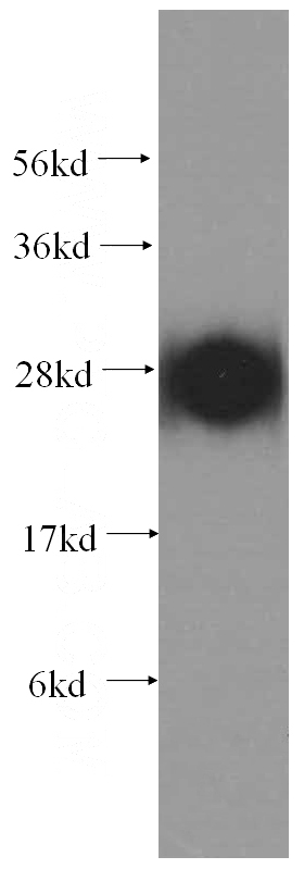 human brain tissue were subjected to SDS PAGE followed by western blot with Catalog No:108310(ATP6V1D antibody) at dilution of 1:500
