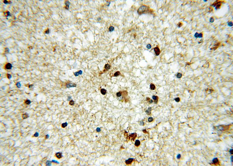 Immunohistochemical of paraffin-embedded human brain using Catalog No:111440(HOXD13 antibody) at dilution of 1:100 (under 40x lens)