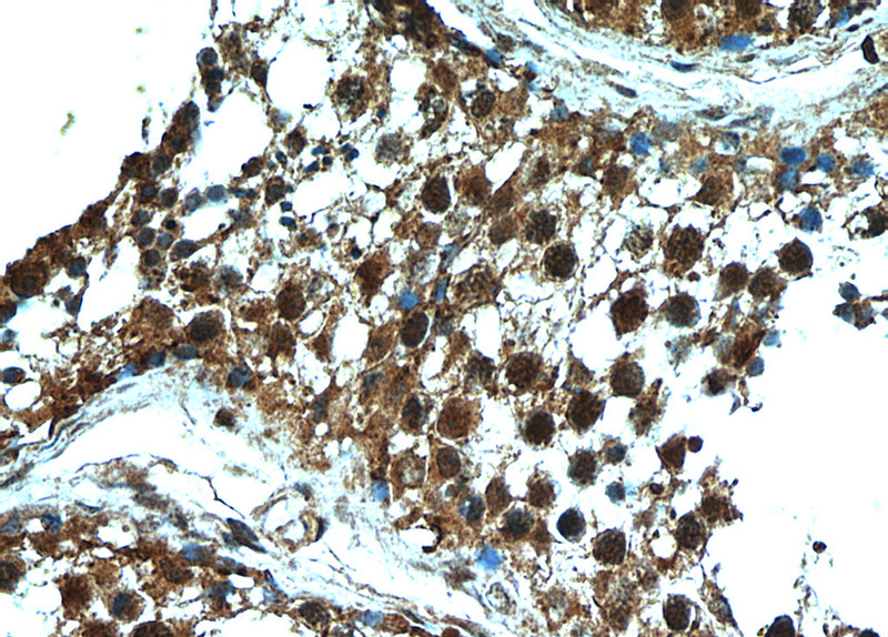 Immunohistochemical of paraffin-embedded human testis using Catalog No:108652(C13orf18 antibody) at dilution of 1:50 (under 40x lens)