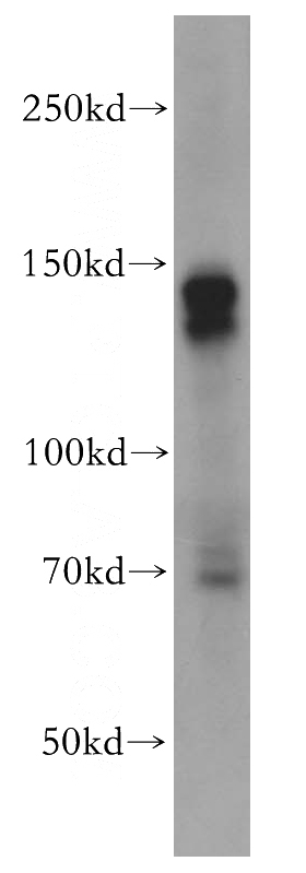 MCF7 cells were subjected to SDS PAGE followed by western blot with Catalog No:109329(KIT antibody) at dilution of 1:200