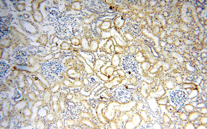 Immunohistochemical of paraffin-embedded human kidney using Catalog No:111545(HSD17B11 antibody) at dilution of 1:100 (under 10x lens)