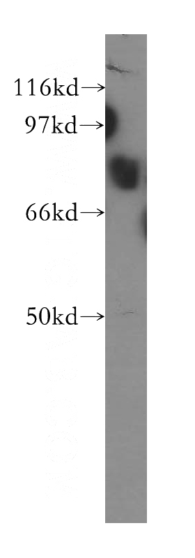 human heart tissue were subjected to SDS PAGE followed by western blot with Catalog No:109456(COP1 antibody) at dilution of 1:500