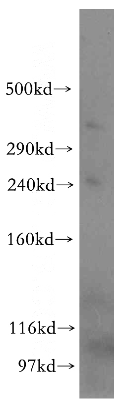 COLO 320 cells were subjected to SDS PAGE followed by western blot with Catalog No:111704(HSPG2-Specific antibody) at dilution of 1:300