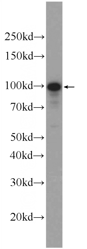 SH-SY5Y cells were subjected to SDS PAGE followed by western blot with Catalog No:115577(SPocD1 Antibody) at dilution of 1:1000