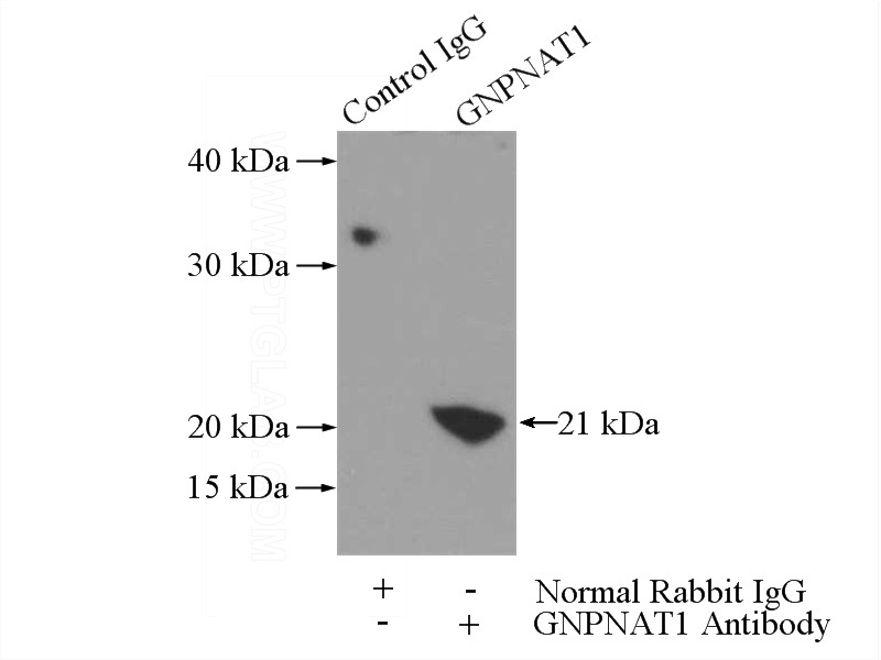 IP Result of anti-GNPNAT1 (IP:Catalog No:111010, 3ug; Detection:Catalog No:111010 1:300) with mouse large intestine tissue lysate 3200ug.