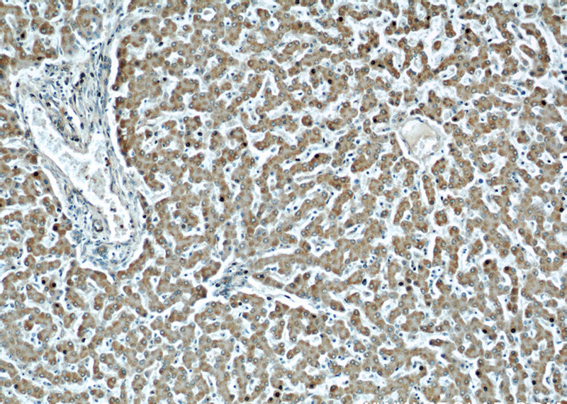 Immunohistochemical of paraffin-embedded human liver using Catalog No:116126(TIMM22 antibody) at dilution of 1:50 (under 10x lens)