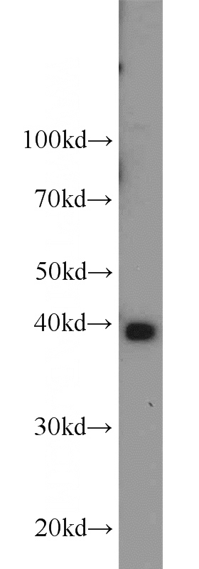mouse brain tissue were subjected to SDS PAGE followed by western blot with Catalog No:114123(PPID antibody) at dilution of 1:1000