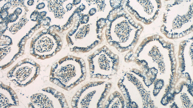 Immunohistochemistry of paraffin-embedded human small intestine tissue slide using Catalog No:115264(SHARPIN Antibody) at dilution of 1:50 (under 10x lens)