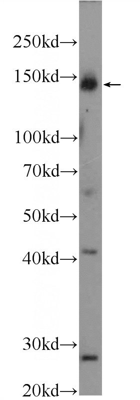 HepG2 cells were subjected to SDS PAGE followed by western blot with Catalog No:113717(EIF2AK3 Antibody) at dilution of 1:300