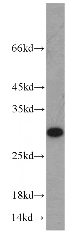 HeLa cells were subjected to SDS PAGE followed by western blot with Catalog No:110398(HSD17B10 antibody) at dilution of 1:1000