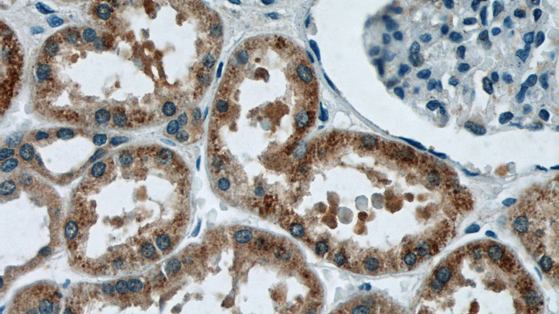 Immunohistochemistry of paraffin-embedded human kidney tissue slide using Catalog No:111510(HNRNPL Antibody) at dilution of 1:50 (under 40x lens)