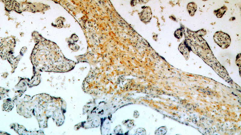 Immunohistochemical of paraffin-embedded human placenta using Catalog No:115475(SNX20 antibody) at dilution of 1:50 (under 10x lens)