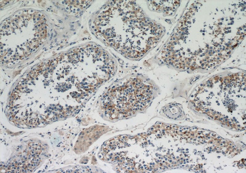 Immunohistochemical of paraffin-embedded human testis using Catalog No:108559(BZW1 antibody) at dilution of 1:100 (under 10x lens)