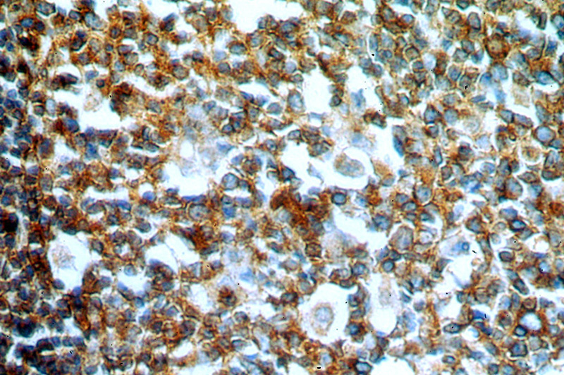 Immunohistochemical of paraffin-embedded human colon using Catalog No:110912(GCNT2 antibody) at dilution of 1:50 (under 40x lens)