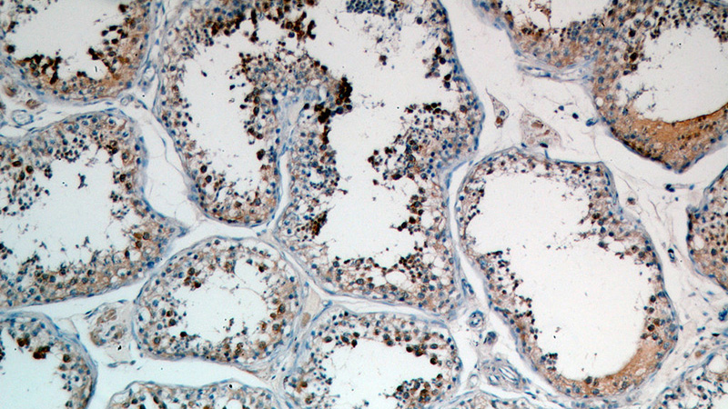 Immunohistochemical of paraffin-embedded human testis using Catalog No:117214(BOLL antibody) at dilution of 1:50 (under 10x lens)
