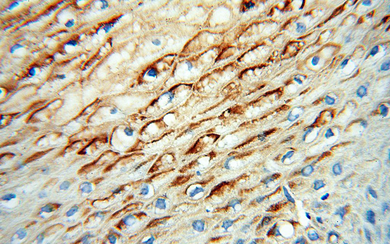 Immunohistochemical of paraffin-embedded human cervix using Catalog No:109806(KRT4 antibody) at dilution of 1:100 (under 40x lens)