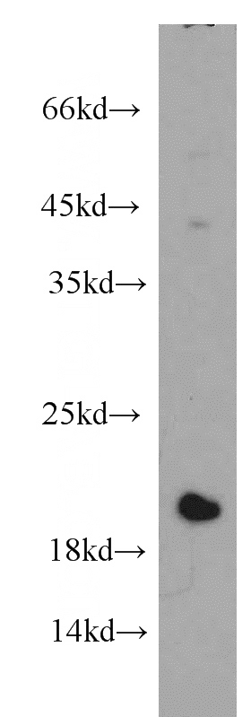 HepG2 cells were subjected to SDS PAGE followed by western blot with Catalog No:108195(ARL1 antibody) at dilution of 1:500