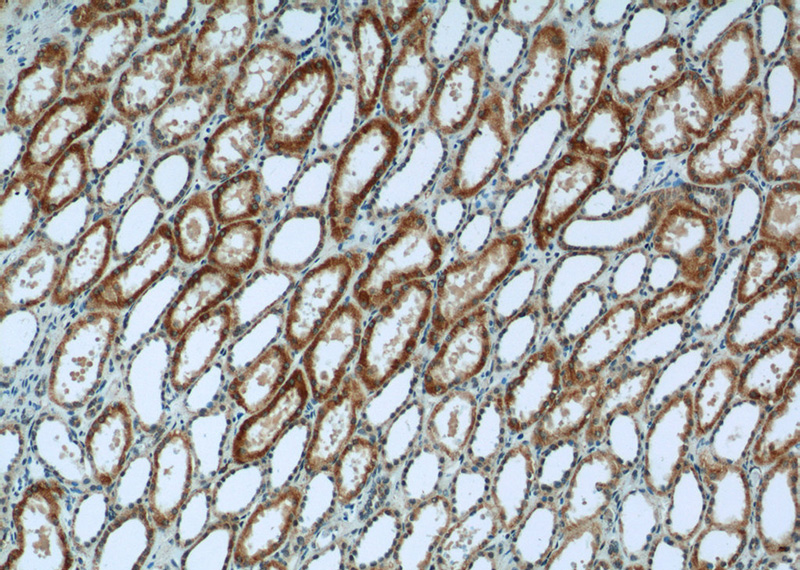 Immunohistochemistry of paraffin-embedded human kidney tissue slide using Catalog No:115031(SDHA Antibody) at dilution of 1:50 (under 10x lens)