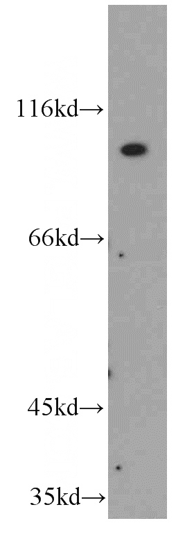 HepG2 cells were subjected to SDS PAGE followed by western blot with Catalog No:110643(FGFR4 antibody) at dilution of 1:400