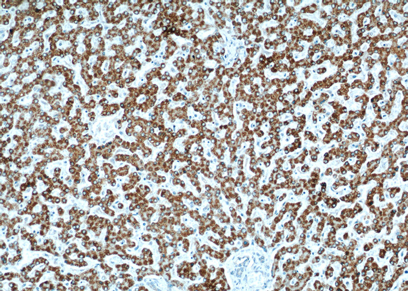 Immunohistochemical of paraffin-embedded human liver using Catalog No:115326(SLC25A2 antibody) at dilution of 1:50 (under 10x lens)