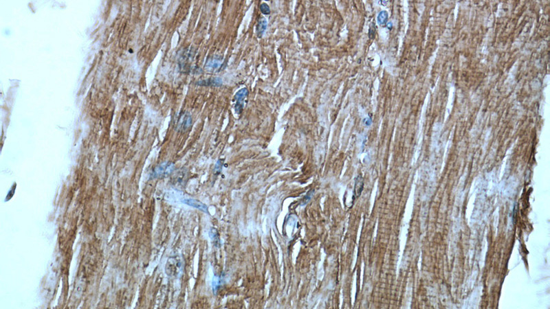 Immunohistochemical of paraffin-embedded human skeletal muscle using Catalog No:110465(FAM120A antibody) at dilution of 1:50 (under 40x lens)