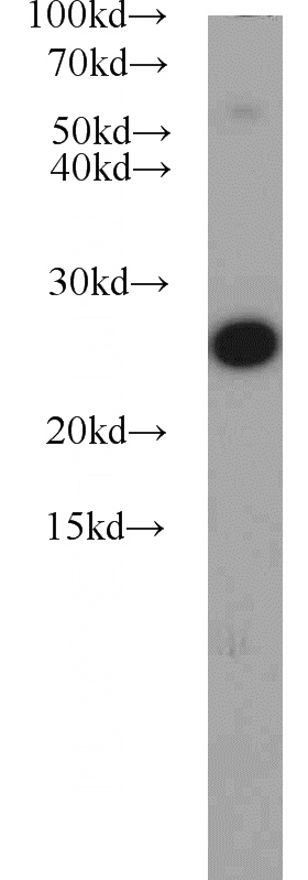 HeLa cells were subjected to SDS PAGE followed by western blot with Catalog No:107923(AK2 antibody) at dilution of 1:800
