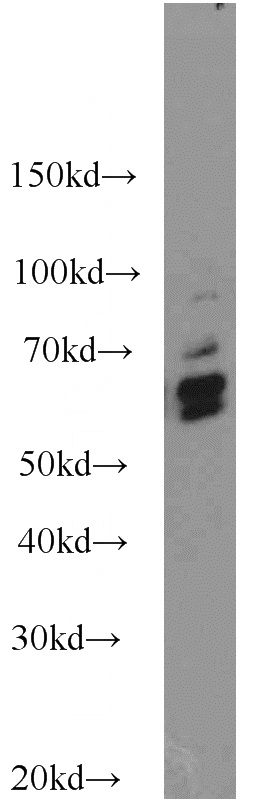 HepG2 cells were subjected to SDS PAGE followed by western blot with Catalog No:112032(KEAP1 antibody) at dilution of 1:2000