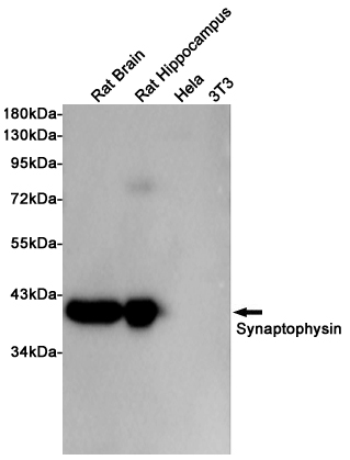 Western blot detection of Synaptophysin in Rat Brain,Rat Hippocampus,Hela,3T3 cell lysates using Synaptophysin (10C8) Mouse mAb(1:1000 diluted).Predicted band size:33.8KDa.Observed band size:38KDa.