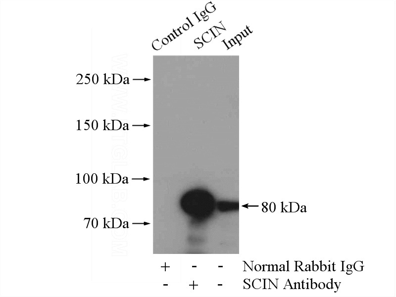IP Result of anti-SCIN (IP:Catalog No:114997, 4ug; Detection:Catalog No:114997 1:300) with human placenta tissue lysate 2800ug.