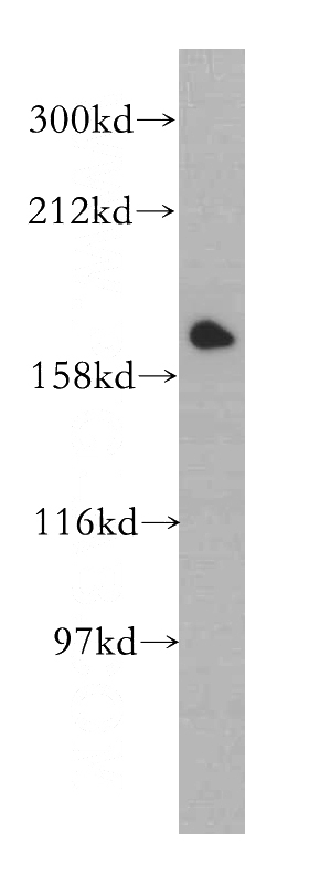 HeLa cells were subjected to SDS PAGE followed by western blot with Catalog No:112912(MYBBP1A antibody) at dilution of 1:500