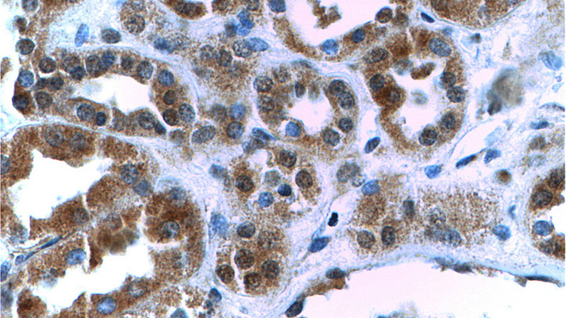 Immunohistochemistry of paraffin-embedded human kidney tissue slide using Catalog No:115252(SIX5 Antibody) at dilution of 1:200 (under 40x lens)