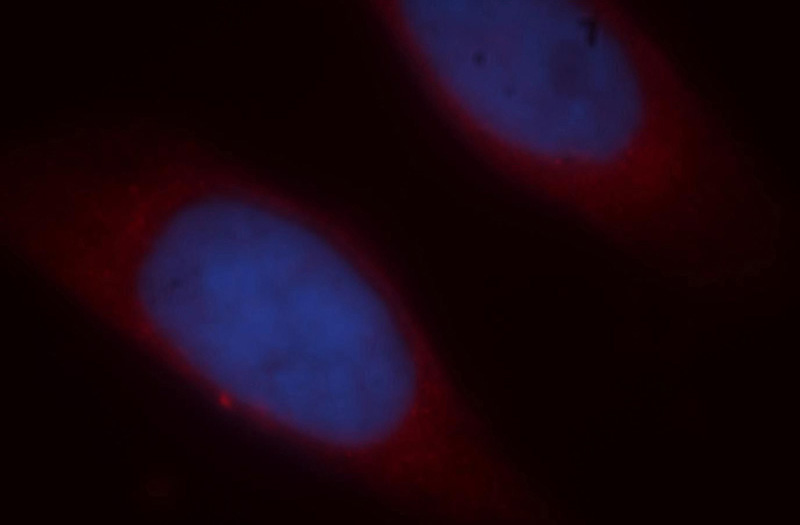 Immunofluorescent analysis of Hela cells, using ICA1L antibody Catalog No:111584 at 1:25 dilution and Rhodamine-labeled goat anti-rabbit IgG (red). Blue pseudocolor = DAPI (fluorescent DNA dye).