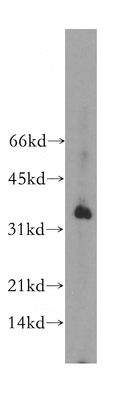 mouse lung tissue were subjected to SDS PAGE followed by western blot with Catalog No:114070(POU2AF1 antibody) at dilution of 1:500