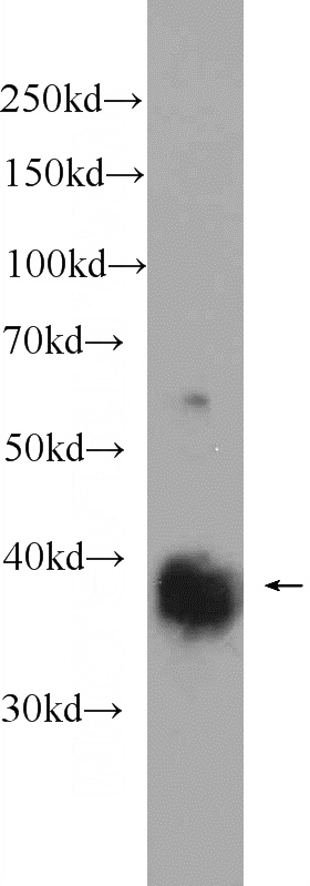 fetal human brain tissue were subjected to SDS PAGE followed by western blot with Catalog No:114687(REM2 Antibody) at dilution of 1:1000