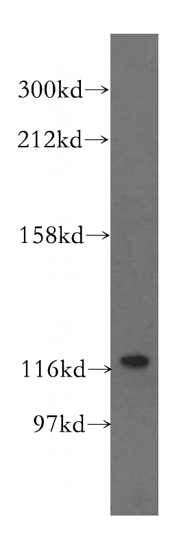HeLa cells were subjected to SDS PAGE followed by western blot with Catalog No:116716(VARS2 antibody) at dilution of 1:500