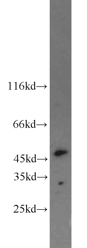 mouse uterus tissue were subjected to SDS PAGE followed by western blot with Catalog No:111793(ING3 antibody) at dilution of 1:800