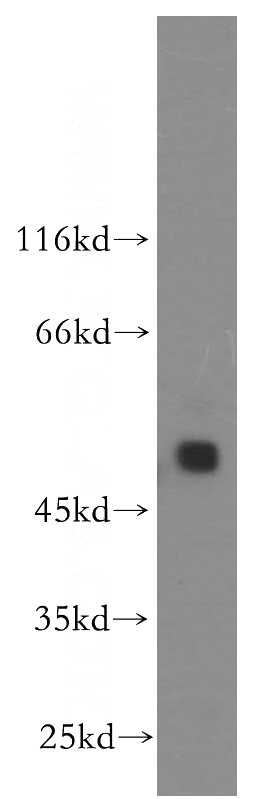 human brain tissue were subjected to SDS PAGE followed by western blot with Catalog No:115815(STYK1 antibody) at dilution of 1:600