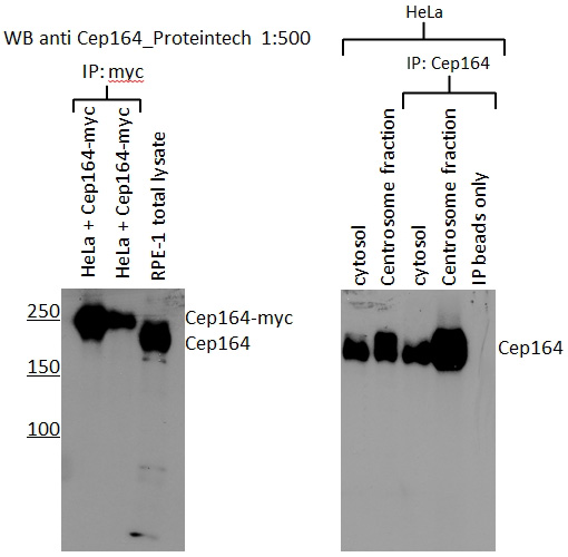 WB results of CEP164 (Catalog No:109267, 1:500) with RPE1 cells by Laboratory of Protein Dynamics and Signaling; Center for Cancer Research, National Cancer Institute.